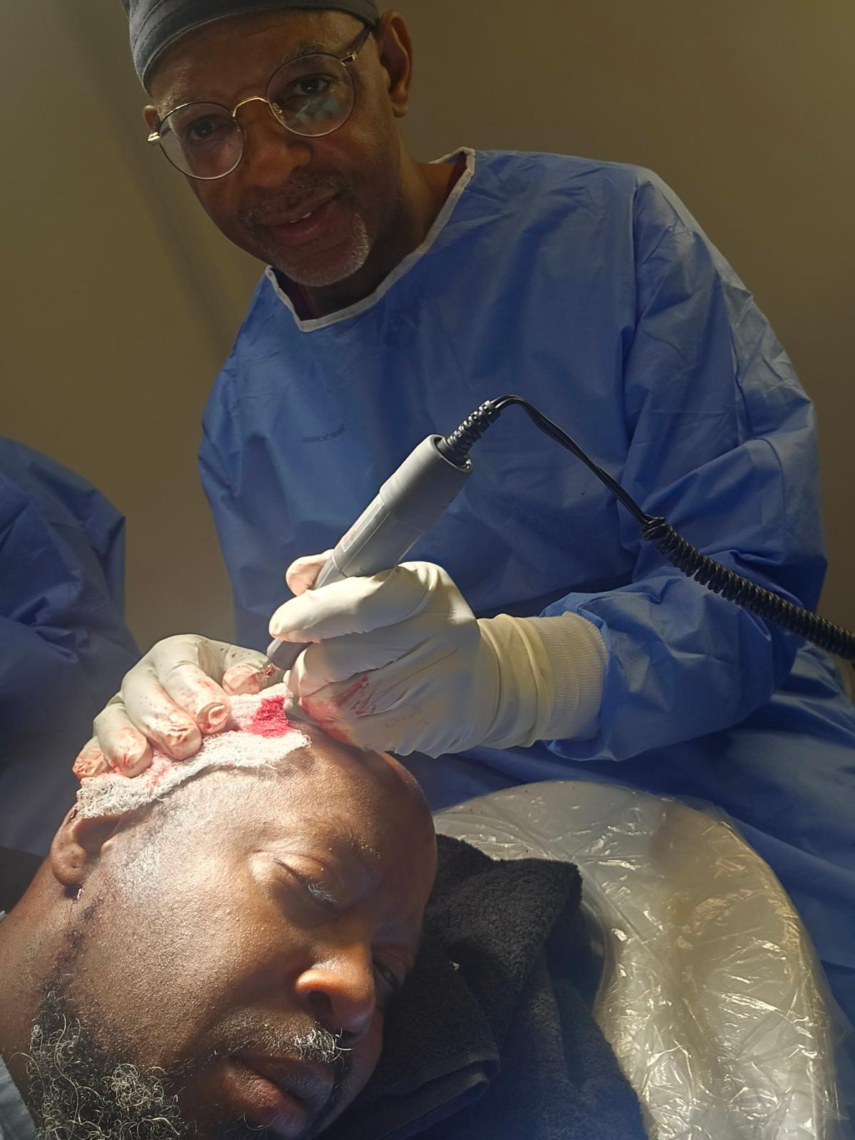 Hair Transplant